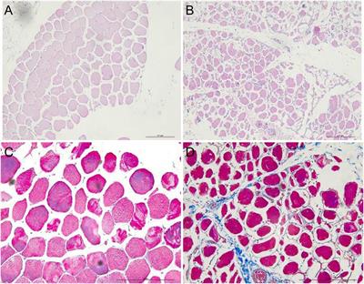 Ficus carica L. Attenuates Denervated Skeletal Muscle Atrophy via PPARα/NF-κB Pathway
